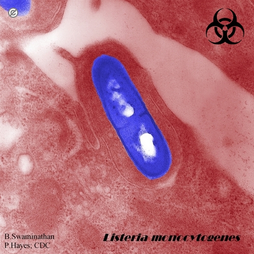 listeria monocytogenes micrograph
